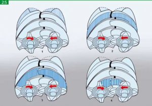 無(wú)油螺桿空壓機和噴油螺